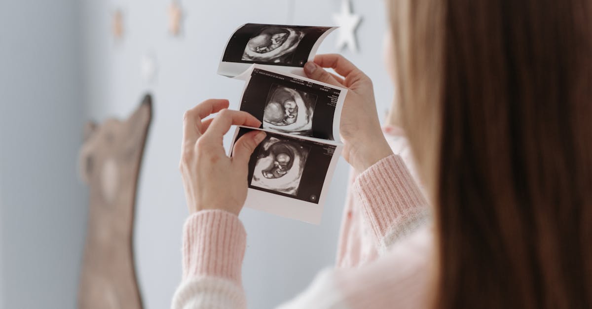 découvrez comment l'échographie, une technique d'imagerie médicale non invasive, permet de visualiser en temps réel les organes internes et de poser des diagnostics précis. explorez les divers usages de l'échographie, des examens de grossesse à l'évaluation des pathologies.
